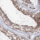 Immunohistochemical staining of human testis shows high expression.