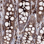 Immunohistochemical staining of human colon using Anti-PEX13 antibody HPA032142.