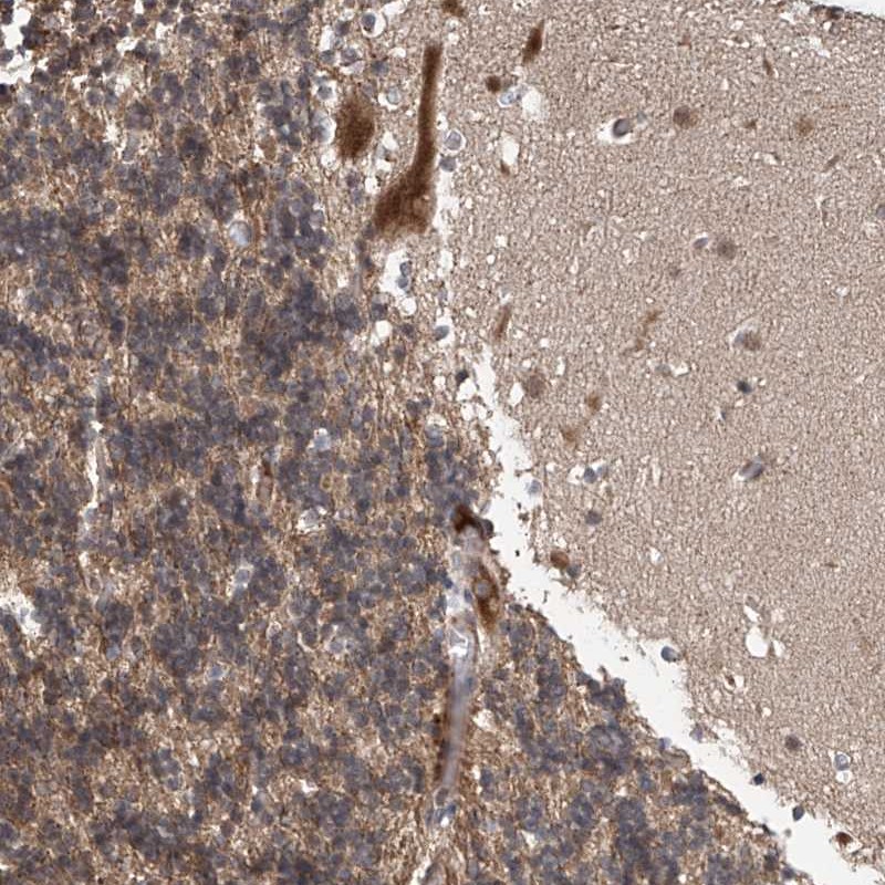 Anti-ABHD13 Antibody