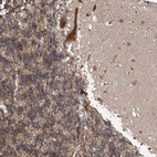 Anti-ABHD13 Antibody