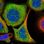 Immunofluorescent staining of human cell line A-431 shows localization to cytosol.