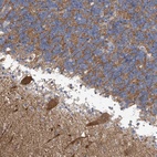 Anti-ABHD13 Antibody