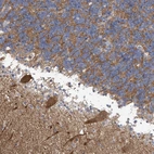 Anti-ABHD13 Antibody