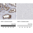 Anti-ANO1 Antibody