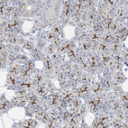 Anti-ANO1 Antibody