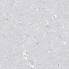 Immunohistochemical staining of human cerebral cortex shows no positivity in neurons as expected.