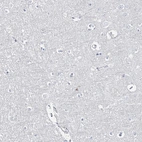 Immunohistochemical staining of human cerebral cortex shows no positivity in neurons as expected.