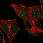 Immunofluorescent staining of human cell line SH-SY5Y shows localization to nucleoplasm.