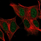 Immunofluorescent staining of human cell line SH-SY5Y shows localization to nucleoplasm.