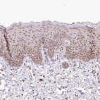 Immunohistochemical staining of human skin shows moderate nuclear positivity in squamous epithelial cells.