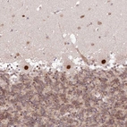 Immunohistochemical staining of human cerebellum shows strong nuclear positivity in Purkinje cells.