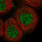 Immunofluorescent staining of human cell line A-431 shows localization to nucleoplasm.