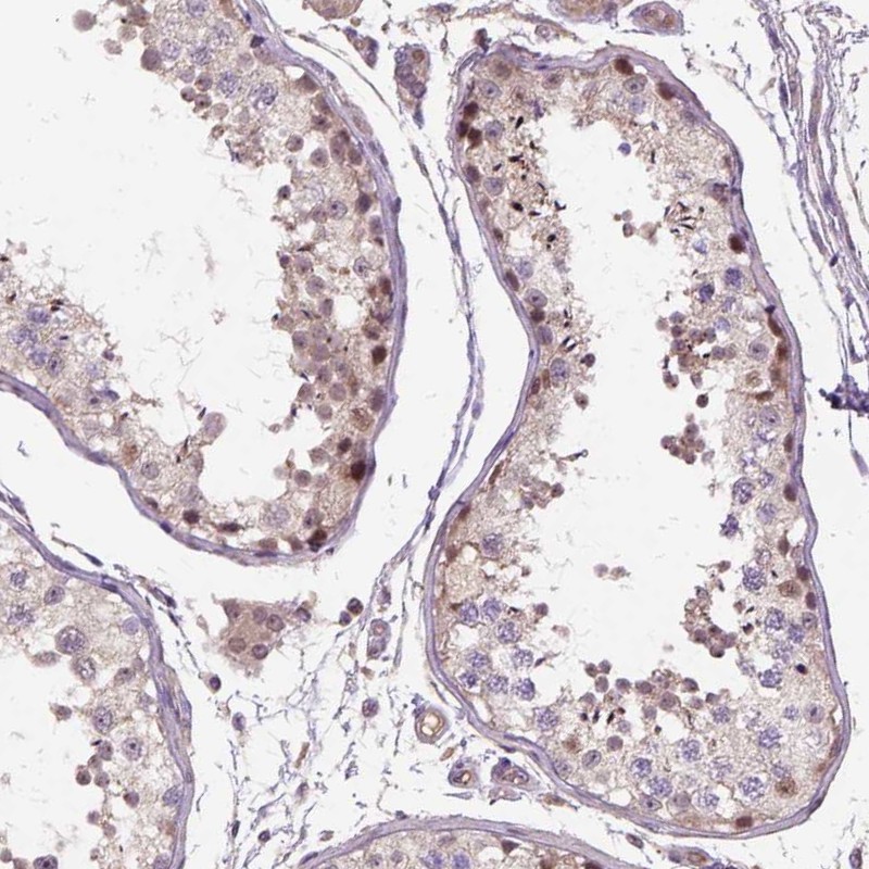 Anti-C6orf106 Antibody