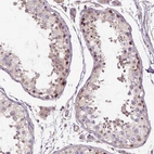 Anti-C6orf106 Antibody