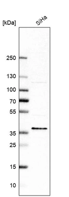 Western blot analysis in human cell line SiHa.