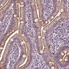 Anti-C6orf106 Antibody