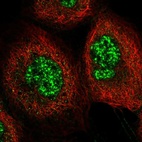 Immunofluorescent staining of human cell line A-431 shows localization to nuclear speckles.