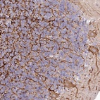 Anti-EFHC2 Antibody