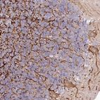 Anti-EFHC2 Antibody