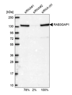 Western blot analysis in U2OS cells transfected with control siRNA, target specific siRNA probe #1 and #2, using Anti-RAB3GAP1 antibody. Remaining relative intensity is presented.