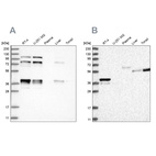 Western blot analysis using Anti-PLEKHA3 antibody HPA034496 (A) shows similar pattern to independent antibody HPA034497 (B).