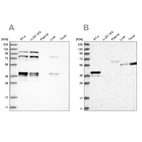 Western blot analysis using Anti-PLEKHA3 antibody HPA034496 (A) shows similar pattern to independent antibody HPA034497 (B).