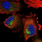 Immunofluorescent staining of human cell line U-251 MG shows localization to the Golgi apparatus.