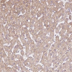 Anti-ERAP2 Antibody