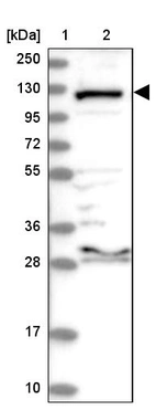 Lane 1: Marker [kDa] 250, 130, 95, 72, 55, 36, 28, 17, 10_br/_Lane 2: Human cell line RT-4