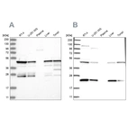 Western blot analysis using Anti-PPP1R7 antibody HPA034500 (A) shows similar pattern to independent antibody HPA034501 (B).