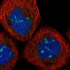 Immunofluorescent staining of human cell line A-431 shows localization to nucleoli.