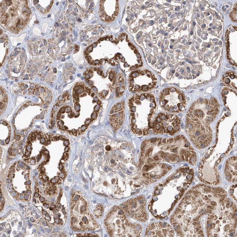 Anti-PPP1R7 Antibody