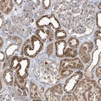 Anti-PPP1R7 Antibody