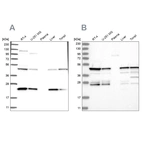 Western blot analysis using Anti-PPP1R7 antibody HPA034501 (A) shows similar pattern to independent antibody HPA034500 (B).