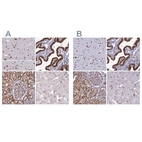 Anti-DDX1 Antibody