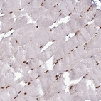 Immunohistochemical staining of human skeletal muscle shows strong nuclear positivity in myocytes.