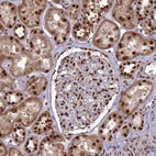 Immunohistochemical staining of human kidney shows strong cytoplasmic/nuclear positivity in cells in tubules and nuclear positivity in cells in glomeruli.