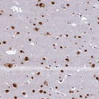 Immunohistochemical staining of human cerebral cortex shows strong cytoplasmic/nuclear positivity in neurons and nuclear positivity in glial cells.