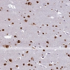 Immunohistochemical staining of human cerebral cortex shows strong cytoplasmic/nuclear positivity in neurons and nuclear positivity in glial cells.