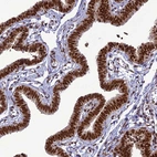Immunohistochemical staining of human fallopian tube shows strong cytoplasmic/nuclear positivity in glandular cells.