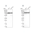 Western blot analysis using Anti-DDX1 antibody HPA034502 (A) shows similar pattern to independent antibody HPA034503 (B).