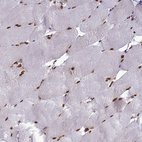 Immunohistochemical staining of human skeletal muscle shows strong nuclear positivity in myocytes.
