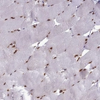 Immunohistochemical staining of human skeletal muscle shows strong nuclear positivity in myocytes.