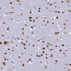 Immunohistochemical staining of human cerebral cortex shows strong cytoplasmic/nuclear positivity in neurons and nuclear positivity in glial cells.