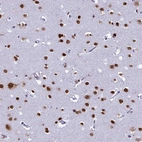 Immunohistochemical staining of human cerebral cortex shows strong cytoplasmic/nuclear positivity in neurons and nuclear positivity in glial cells.