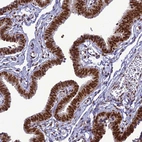 Immunohistochemical staining of human fallopian tube shows strong cytoplasmic/nuclear positivity in glandular cells.
