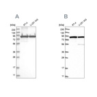 Western blot analysis using Anti-DDX1 antibody HPA034503 (A) shows similar pattern to independent antibody HPA034502 (B).