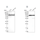 Western blot analysis using Anti-DDX1 antibody HPA034503 (A) shows similar pattern to independent antibody HPA034502 (B).