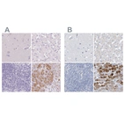 Immunohistochemical staining of human cerebral cortex, liver, lymph node and pancreas using Anti-CTRL antibody HPA034504 (A) shows similar protein distribution across tissues to independent antibody HPA034505 (B).