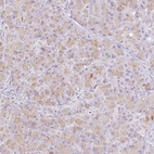 Immunohistochemical staining of human pancreas shows high expression.